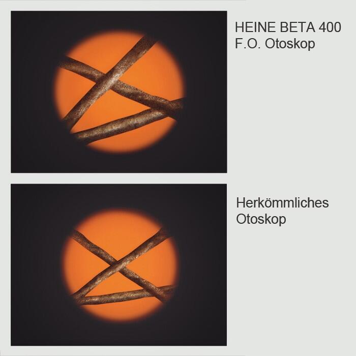 HEINE BETA 400 F.O. Otoskop ohne Griff