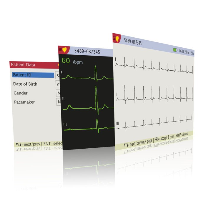 Schiller Cardiovit AT-1 G2  12-Kanal-EKG-Gerät  Bild 2