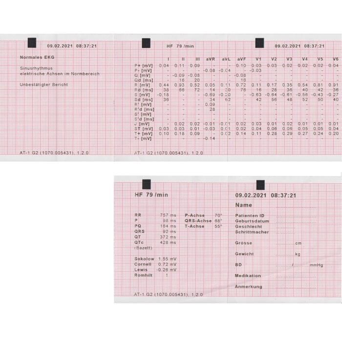 Schiller Cardiovit AT-1 G2  12-Kanal-EKG-Gert 