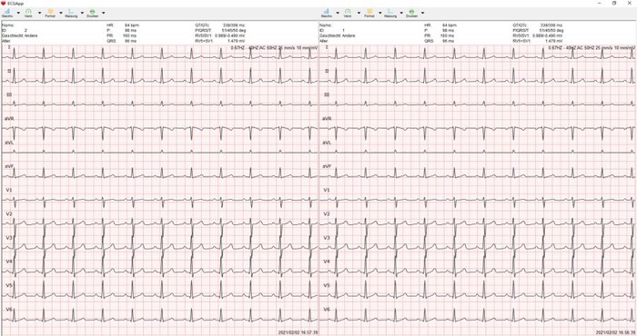 medical Econet E3 EKG-Gerät  Bild 2