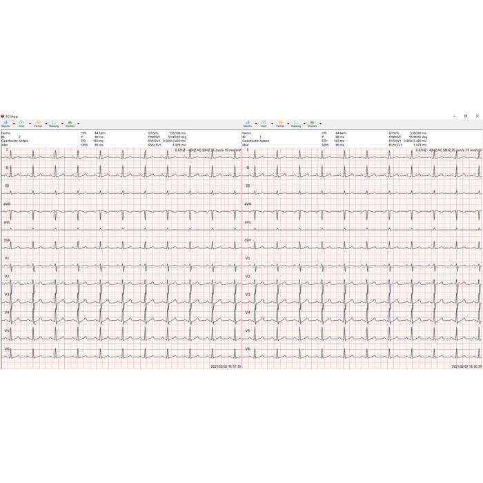 medical Econet E3 EKG-Gert 