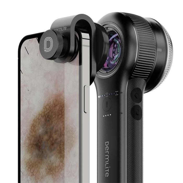 DermLite DL5 Dermatoskop 