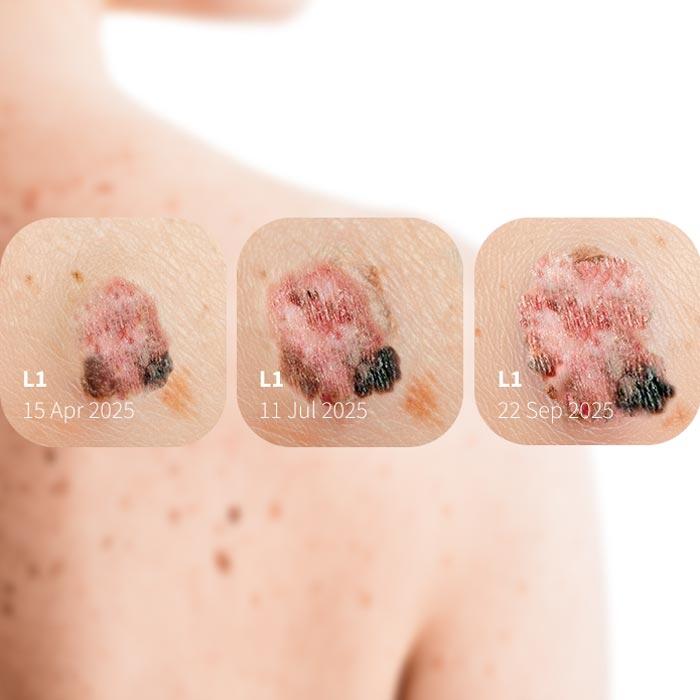 DermLite App Powered by FotoFinder