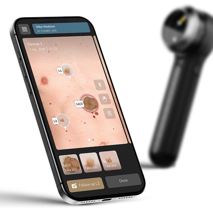 DermLite App Powered by FotoFinder