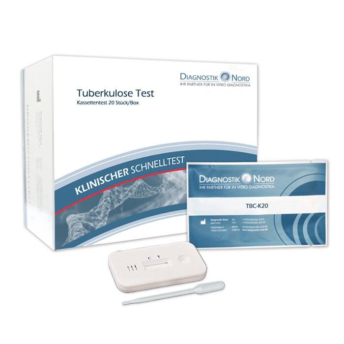Tuberkulose Schnelltest