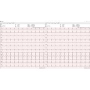 medical Econet E3 EKG-Gert 