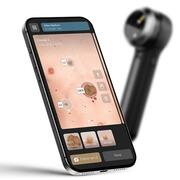 DermLite DL5 Plus Dermatoskop