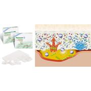 Lohmann-Rauscher Suprasorb X + PHMB