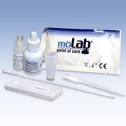 Streptokokkentests