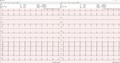 medical Econet Software für EKG E3  inkl. 1 Dongle